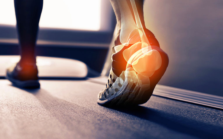 Effective Treatments for Plantar Fasciitis: Relieve Foot Pain and